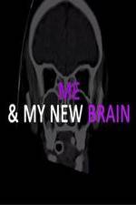 Me &amp; My New Brain